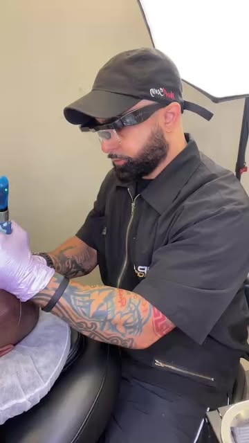 Scalp micropigmentation session 🪄