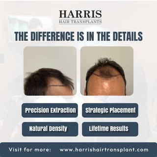 It's not just about moving hair it's about precision, planning, and creating results that look compl