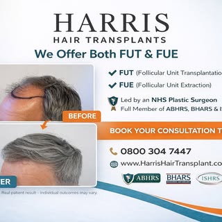 Real patient. Real results.
At Harris Hair Transplants, we offer advanced FUT & FUE hair restoration