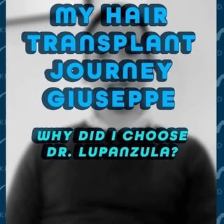 My Hair Transplant Journey: Following Giuseppe's Path to Renewal with Dr. Lupanzula's FUE Mastery👨�