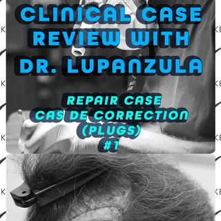 Clinical Case Review with Dr. Emorane Lupanzula #1
Repair Case – Cas de correction (plugs) avancé
