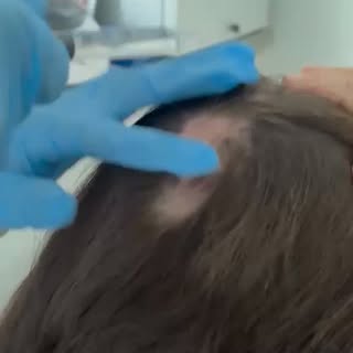 Most people think a scalp massage simply feels nice.

The science tells a much bigger story.

Gentle