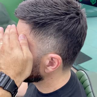 A prótese capilar fica boa em grisalho, crespo, pra quem quer topete ou pra quem deseja o cabelo mai