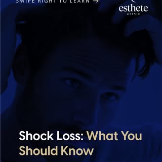 Temporary shedding after hair treatment — known as “shock loss” — can occur during the healing phase