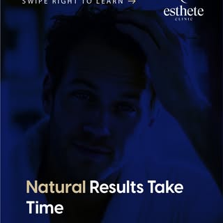 Hair restoration is a gradual process.
Visible growth usually begins after several months, with fina