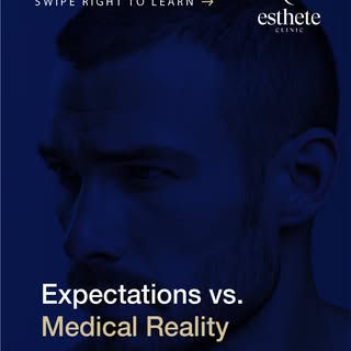 Realistic expectations are essential for satisfaction.
Medical limitations, donor capacity, and hair
