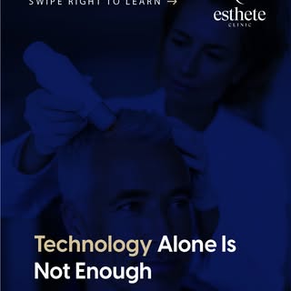 Modern hair devices improve precision — but technology alone does not guarantee success.
Medical exp