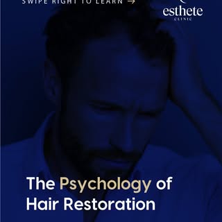 Hair loss is not only physical — it affects confidence and self-perception.
Hair restoration should 