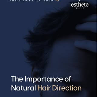 Hair grows in specific natural directions and angles.
Ignoring this can result in an artificial appe