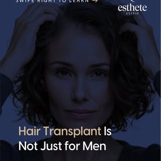 Hair loss also affects women — often differently than men.
Female hair restoration requires careful 
