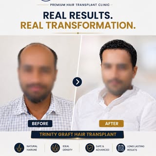 Real Results. Real Transformation.

Hair loss is not just about restoring hair — it's about restorin
