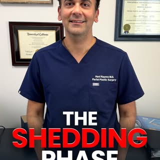 Shedding after you start treatment is one of the most common reasons men quit too early.

In this vi