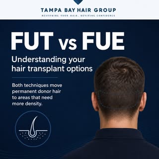 FUT or FUE—which one is better?

The truth is, both can create natural, long-lasting results when th