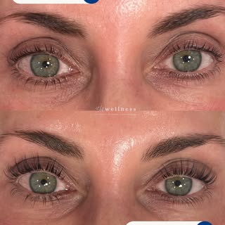 A subtle change can make a big difference.

This beautiful before & after Lash Lift + Tint enhances 