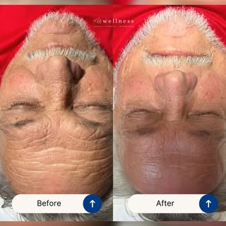 Healthy skin isn’t just for the ladies.

This Gentlemen’s Facial before & after shows what a customi