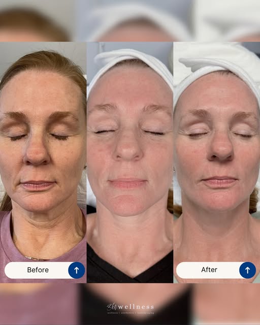 Why does sun damage seem to show up more in September? ☀️

After months of summer sun, you might sta