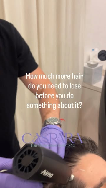 Most men know their hair is thinning long before they actually do something about it. A receding hai