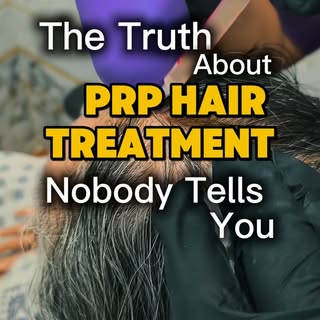 ✨ The PRP truth nobody tells you 👀

PRP Hair Treatment is not just an injection… it’s a science-bas