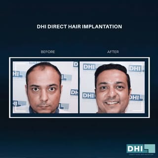 Transformation definitely worthy of such a beaming smile. Thank you for trusting DHI!

DM us for fre