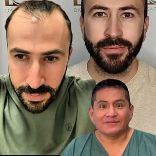 En este vídeo, mostramos el resultado final a los 12 meses. Una intervención realizada por el Dr. Da