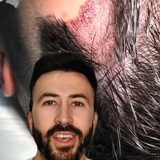 “Daniel te lleva todo el proceso”
Gracias Manuel por compartir tu experiencia con tanta honestidad. 