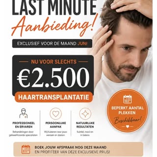 🔥 LAST MINUTE ACTIE 🔥

Droom jij van een vollere haarlijn?
Profiteer nu van onze juni-deal:

💇‍♂️