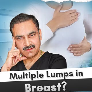 Not every lump means cancer, but every lump needs attention.
Multiple breast lumps can have differen