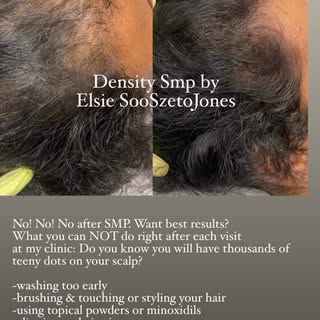 Those who can’t or don’t want to follow the after care instructions after your Scalp Micropigmentati