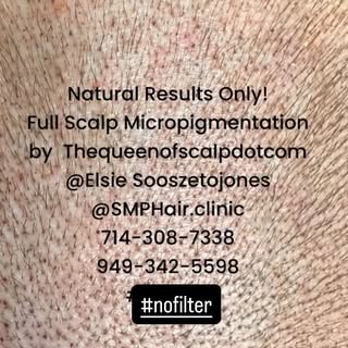 #thequeenofscalpdotcom #scalpmicropigmentation #beforeandafter #thequeenofscalp #hairtattoo