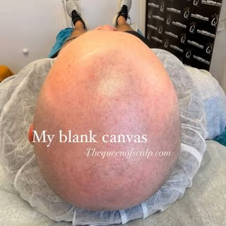 Bald doesn’t have to mean confidence lost. Watch this incredible transformation by The Queen of Scal