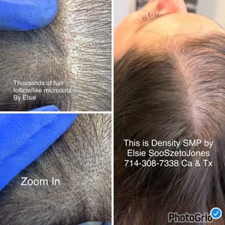 Why is SMP by @elsiesooszetojones_smp popular? Density SMP (Scalp Micropigmentation) is great for th