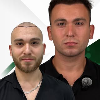 Emre’nin 6 Aylık Değişimi 👏

Emre, özellikle saçlarının yan tarafındaki görünümden uzun süredir rah