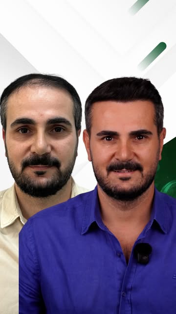 Saçım ekilmiş gibi durmuyor!

Asıl hedefimiz de tam olarak bu.
Doğal saç çizgisi, doğru açı ve doğru