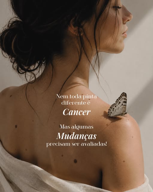 Você não precisa olhar para cada pinta com medo. Precisa conhecer a sua pele o suficiente para perce