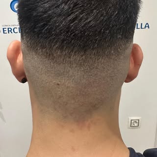 Esta foto no tiene filtros… tiene dos cirugias de algo más de 3000 UF cada una… y … las marcas de la