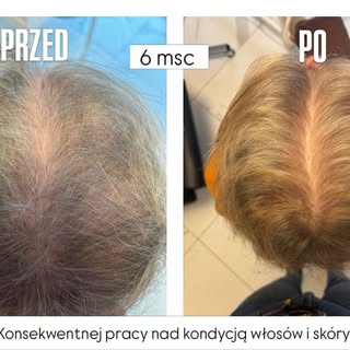 6 miesięcy. Tyle czasu dzieli te dwa zdjęcia.

I właśnie dlatego nie wierzę w obietnice typu „odbudu