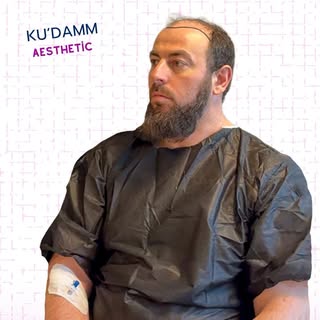 Haartransplantation Berlin: Methoden, Kosten & Erfahrungen
Erfahren Sie alles über Methoden, Kosten 