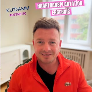 Haartransplantation in Berlin – wie kann ein Ergebnis nach dem Eingriff aussehen?

Bei KU’DAMM AESTH