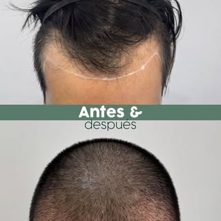 Cada caso es diferente, por eso trabajamos con valoración médica personalizada y seguimiento profesi
