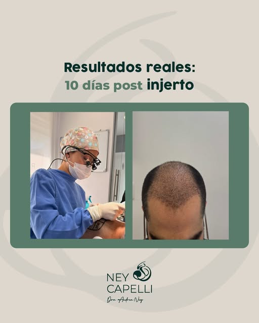 10 días. Un resultado real. ✨

Así luce la evolución después de solo 10 días. Cada proceso es difere