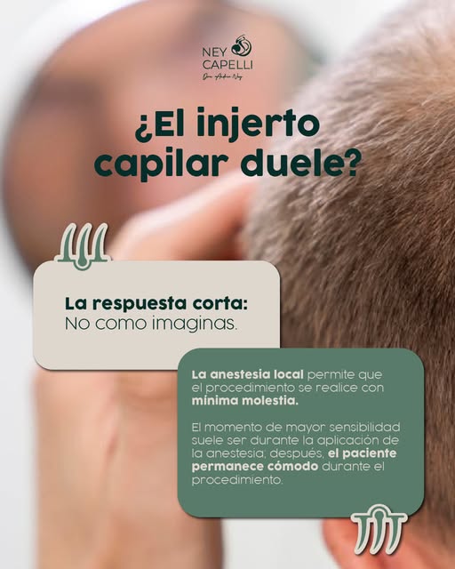 ¿El injerto capilar duele? 🤔

Una de las dudas más comunes antes del procedimiento. La experiencia 