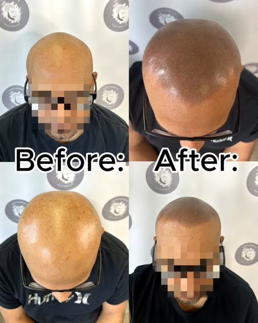 Look closely at this transformation. The key to a great result isn't just filling sparse areas—it’s 