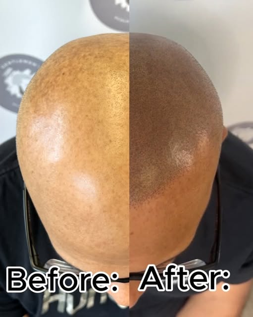 Look closely at this transformation. The key to a great result isn't just filling sparse areas—it’s 