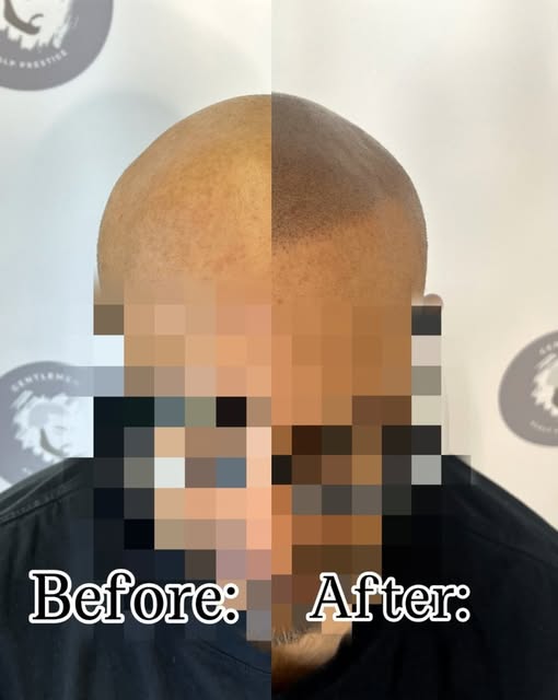 Look closely at this transformation. The key to a great result isn't just filling sparse areas—it’s 