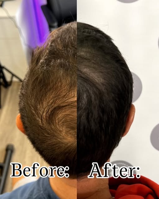 Look closely at this transformation. The key to a great result isn't just filling sparse areas—it’s 