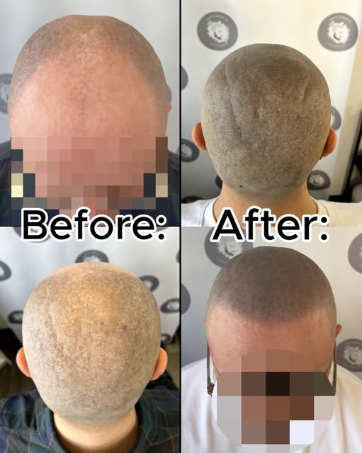 Look closely at this transformation. The key to a great result isn't just filling sparse areas—it’s 