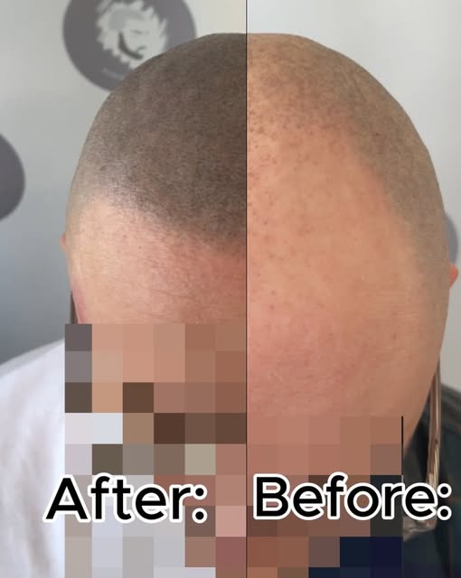 Look closely at this transformation. The key to a great result isn't just filling sparse areas—it’s 