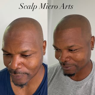 (Healed results)

Sometimes the best transformations begin with patience. 

About a year ago, this c