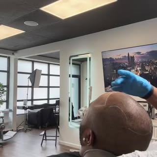 Scalp micro pigmentation 
Best results ever…..
@barber_ink_ny