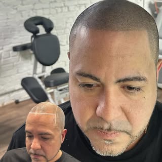 Experience a New You. Scalp Micro Pigmentation is Your 100% effective solution to hair loss. This in